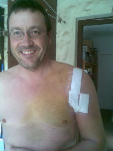 Andy stitched up...: The dressing has subsequently come off. Looks like the arm has been sowed back on.